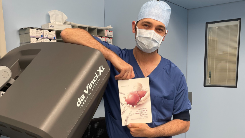 dr. D'Hondt met zijn doctoraatsthesis over minimaal invasieve leverchirurgie